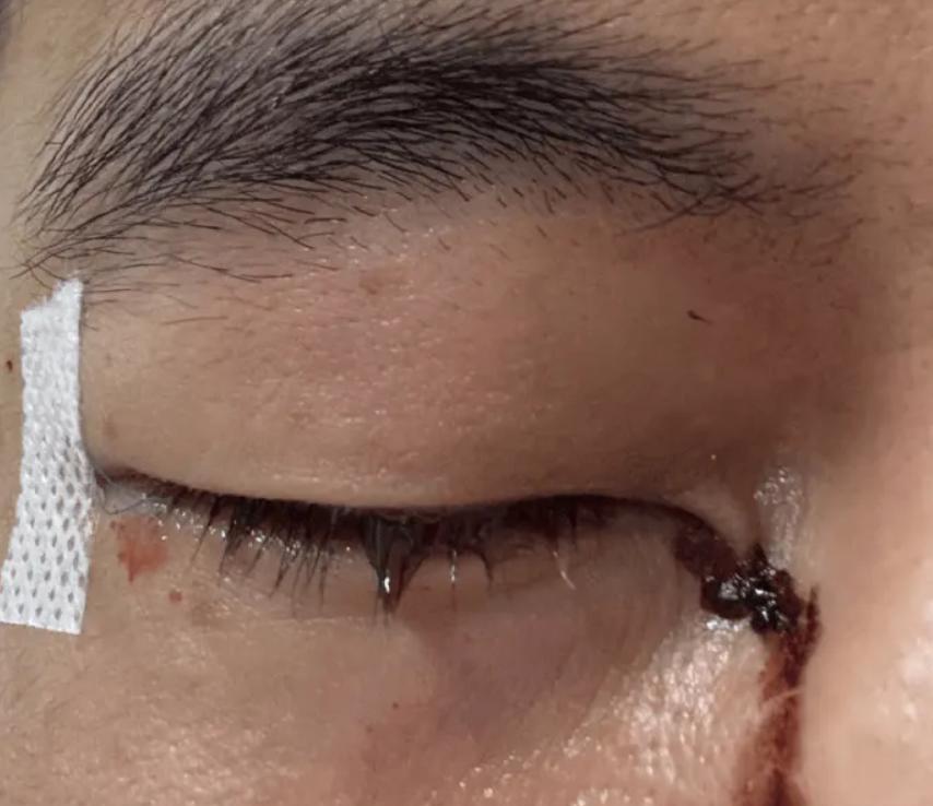 队员伤情紧急！球队备受压力的简单介绍